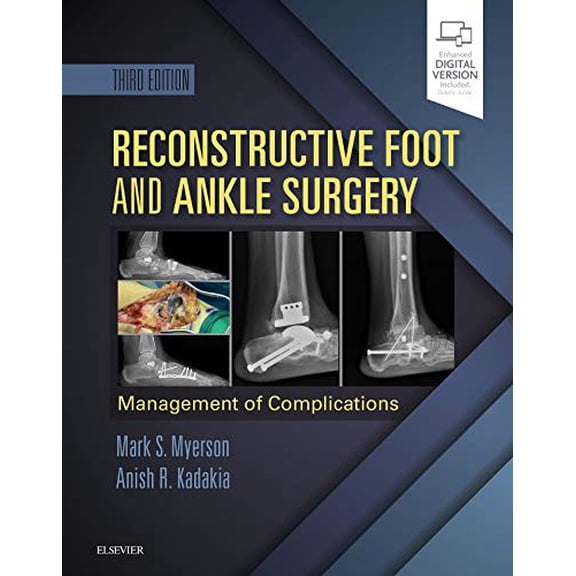 Pre-Owned Reconstructive Foot and Ankle Surgery: Management of Complications: Expert Consult - Online, Print, and DVD [Hardcover] Myerson MD, Mark S. and Kadakia MD, Anish R.