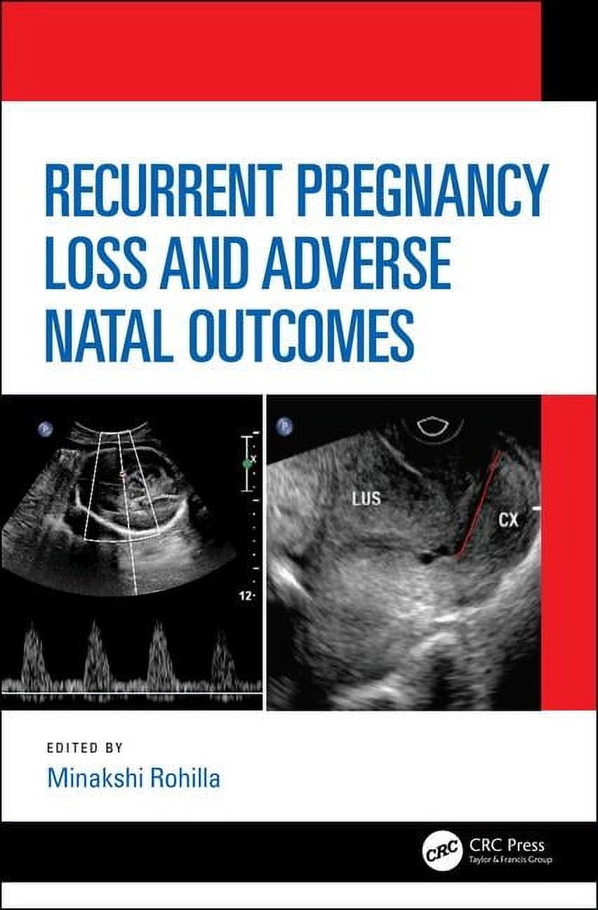 Recurrent Pregnancy Loss and Adverse Natal Outcomes, (Hardcover)
