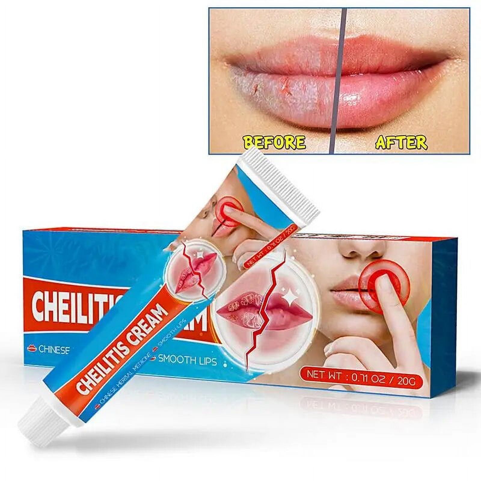 Reduce Fine Lines Lip Balm Cheilitis Cream Remove Dark Oil Moisturizing