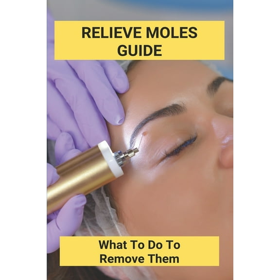 Relieve Moles Guide: What To Do To Remove Them: Getting Rid Of Moles In The Yard (Paperback)