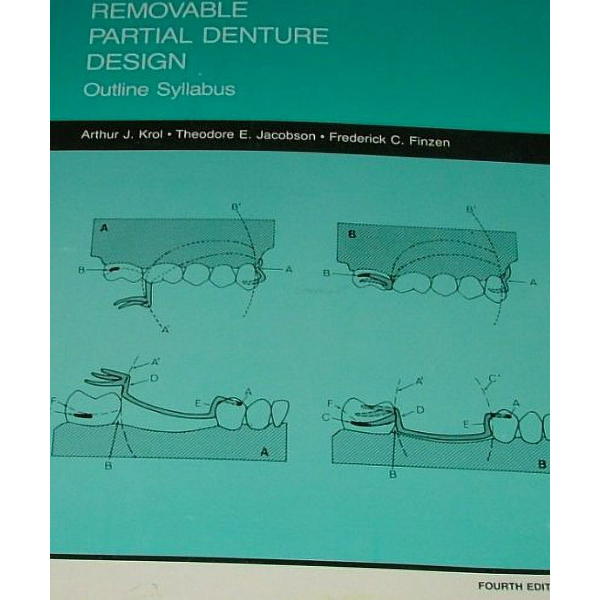 Removable Partial Denture Design