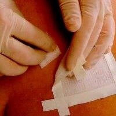 Remove Adhesive Remover Wipe Cleans Adhesive Residue From Skin Box of 50