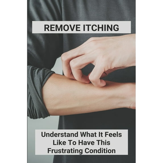 Remove Itching: Understand What It Feels Like To Have This Frustrating Condition: Stretch Marks Itch While Losing Weight (Paperback)