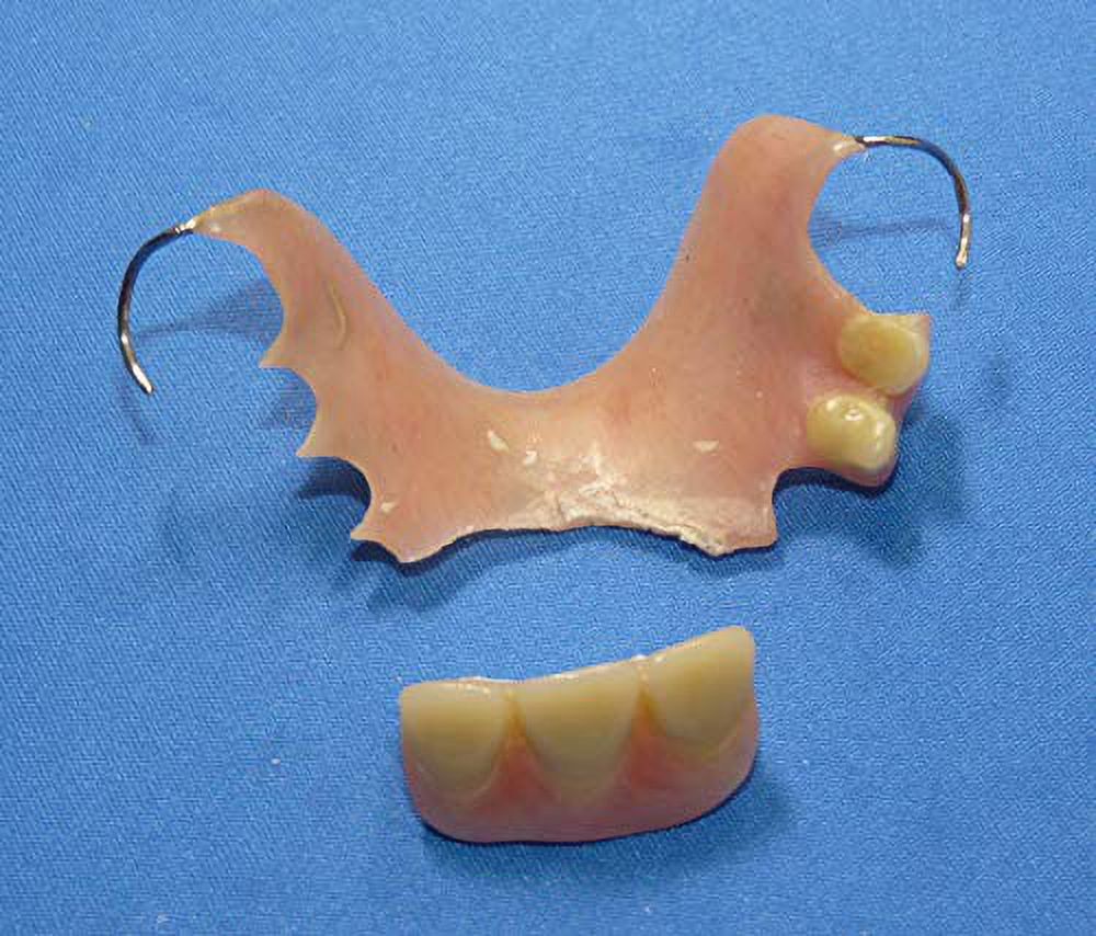 Repair Broken Denture Cracked Denture Repair