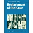 thumbnail image 1 of Replacement of the Knee, (Paperback), 1 of 1