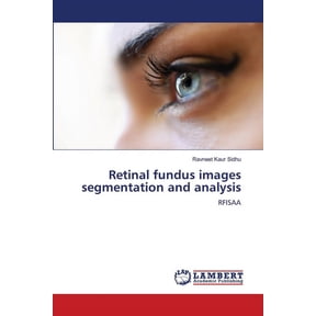 Retinal fundus images segmentation and analysis, (Paperback)