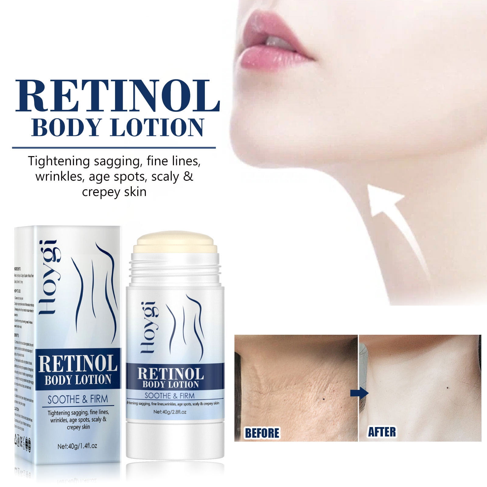 Retinol Body Lotion,Retinol Body Wand For Face And Body,Anti Aging Body