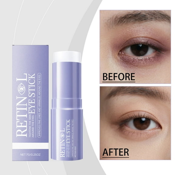 Retinol Eye Stick, Under Eye Balm for Dark Circles and Puffiness, Hyaluronic Acid + Collagen, Anti Aging Reduces Fine Lines Wrinkles Under Eye Bags, Hydrates & Smooths Fine Lines, 0.25oz