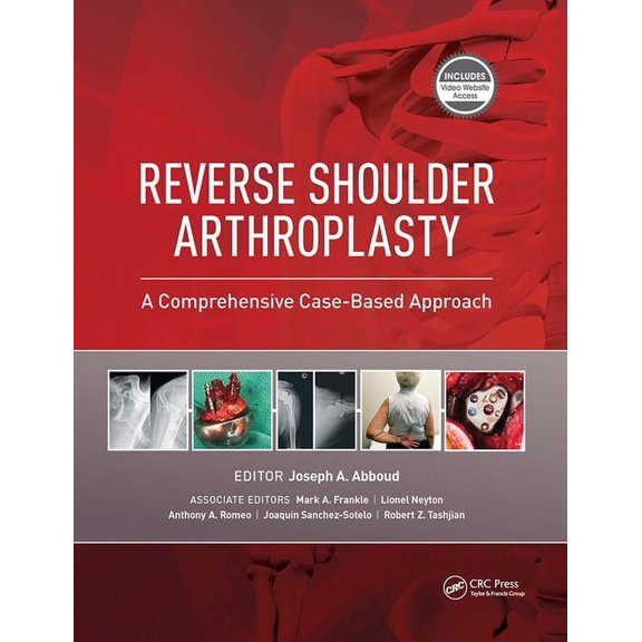 Reverse Shoulder Arthroplasty: A Comprehensive Case-Based Approach, (Hardcover)