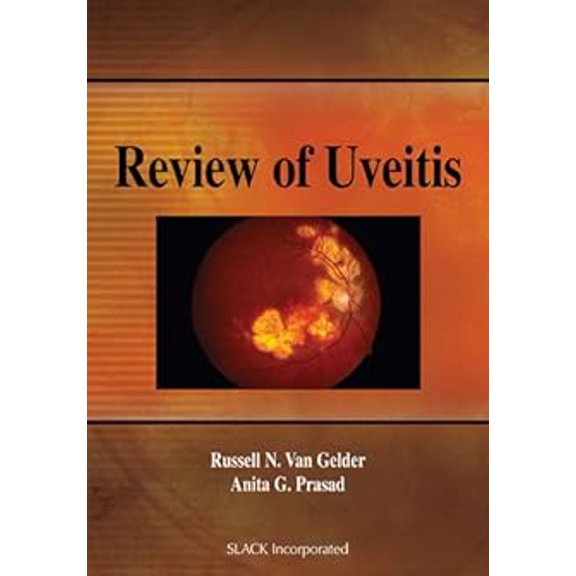 Pre-Owned Review of Uveitis