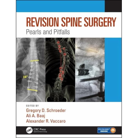 Revision Spine Surgery: Pearls and Pitfalls (Hardcover)