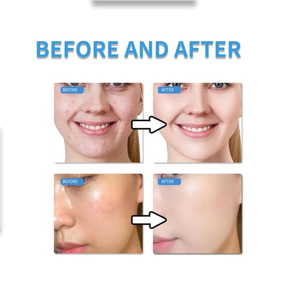 Rewenti Pores Dark Spots Brights White Warm and Non Irritatin Moisturizing and Suitable for Sensitive 50g