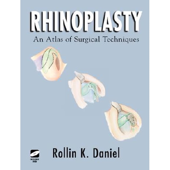 Pre-Owned Rhinoplasty: An Atlas of Surgical Techniques