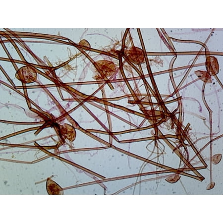 Rhizopus Sexual Reproduction, Conjugation (Showing Zygotes); Whole-mount by Go Science Crazy