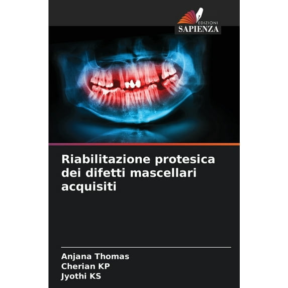 Riabilitazione protesica dei difetti mascellari acquisiti (Paperback)