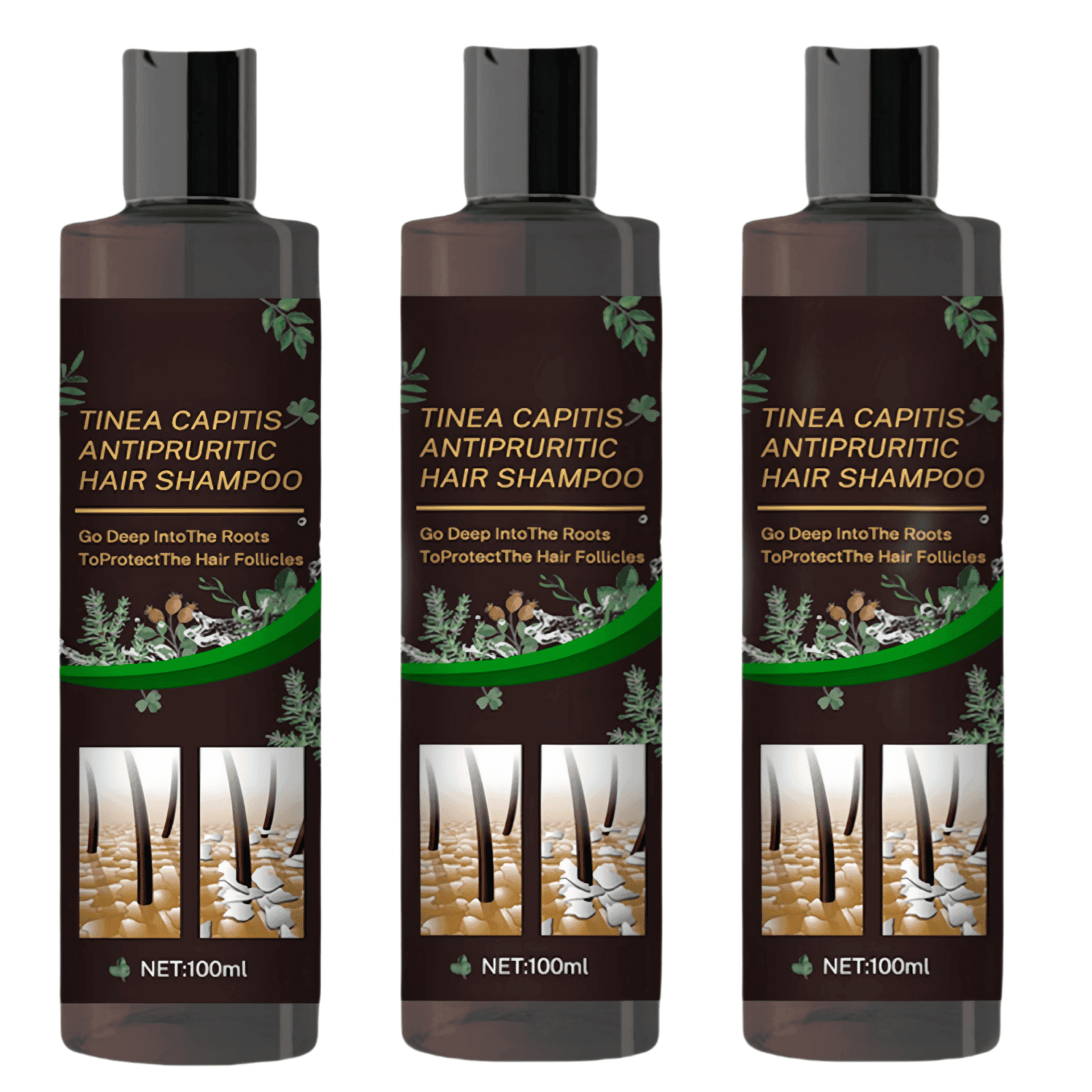 Ringshlar Hair Shampoo for Tinea Capitis Antipuritic Professional Antidandruff Remove Mites and Relieve Itching Shampoo 10.14 Oz