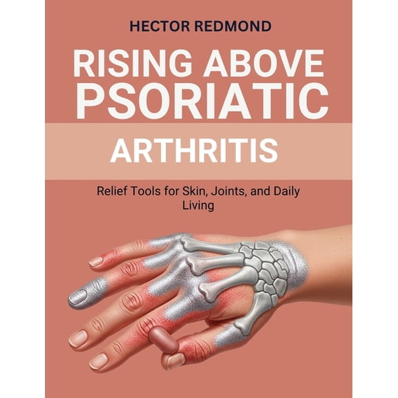 Rising Above Psoriatic Arthritis: Relief Tools for Skin, Joints, and Daily Living, (Paperback)