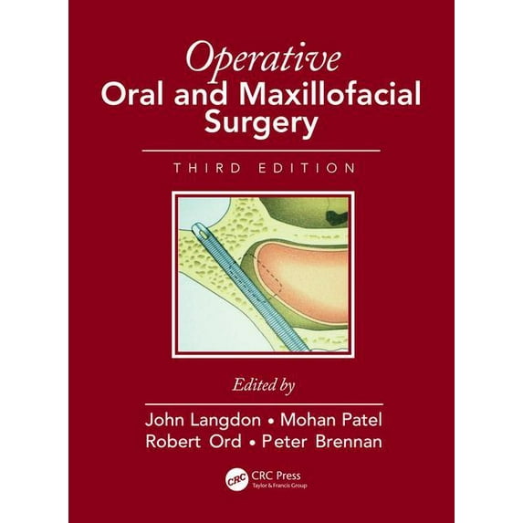 Rob & Smith's Operative Surgery: Operative Oral and Maxillofacial Surgery (Hardcover)