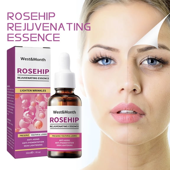 Rosehip Can Firm Moisturize Fade Fine Lines Fade Facial Spots And Whiten 30ml