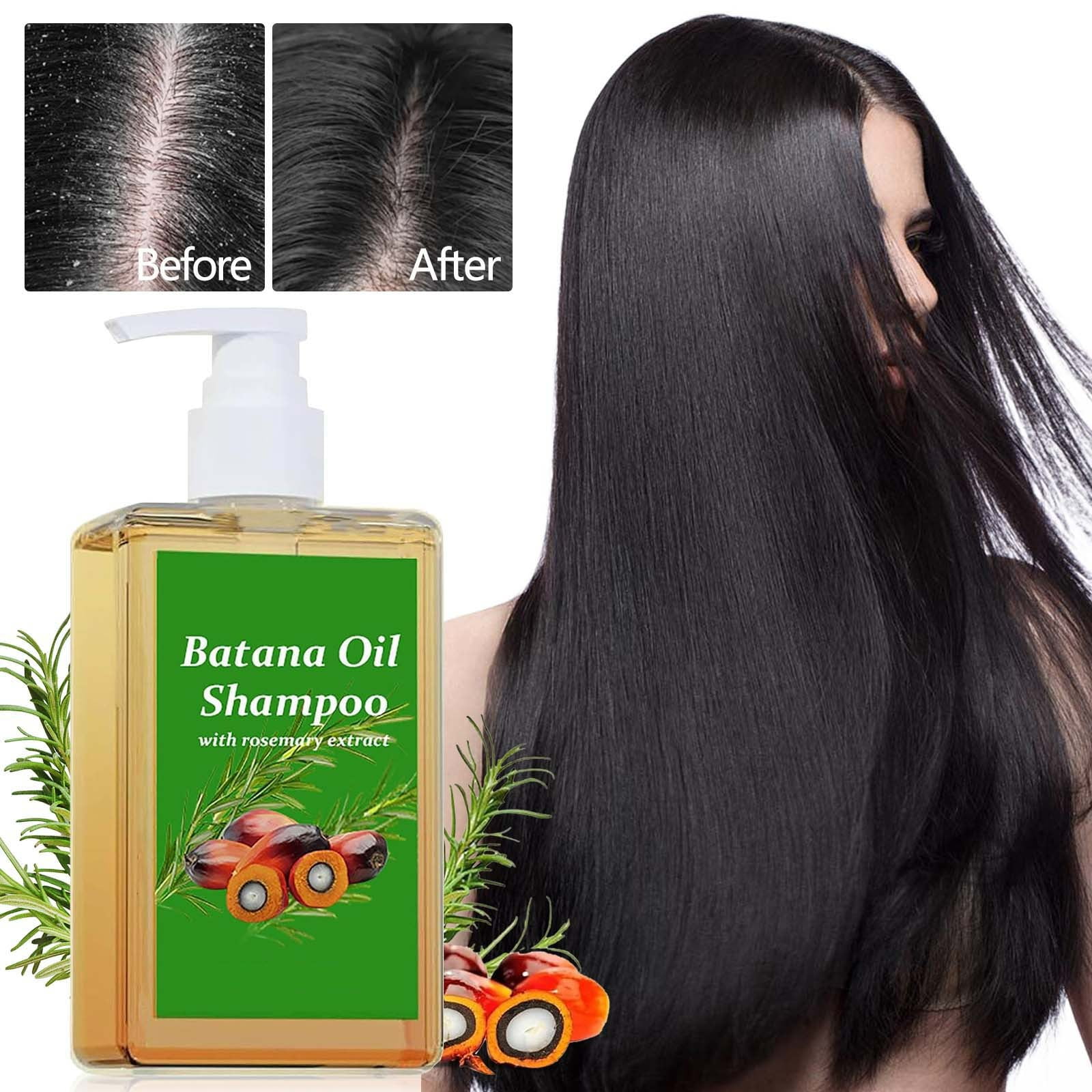 Batana Öl Shampoo Mit Rosmarin – Für Haarwachstum & Strapaziertes Haar (Männer & Frauen)