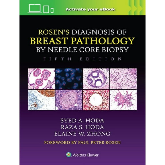 Rosen's Diagnosis of Breast Pathology by Needle Core Biopsy, (Hardcover)