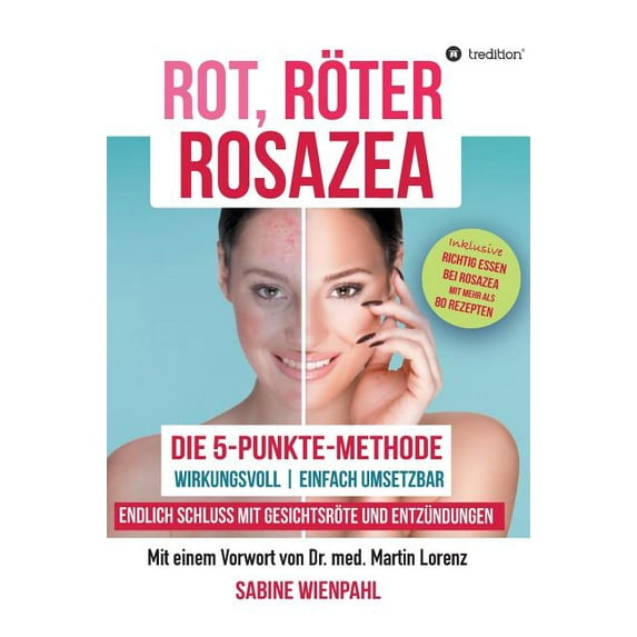 Rot Röter Rosazea (Hardcover)