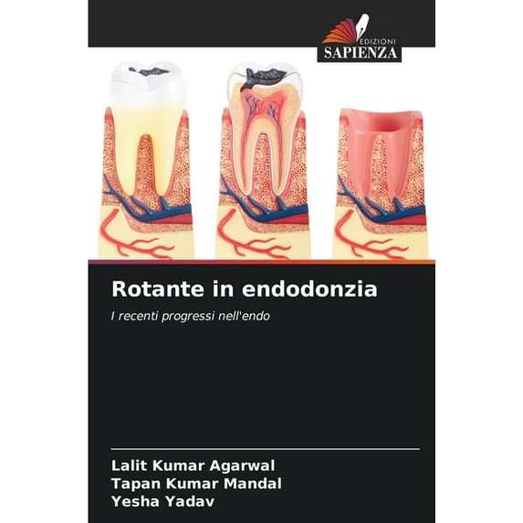 Rotante in endodonzia (Paperback)