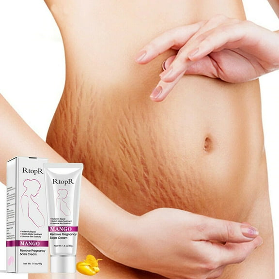 RtopR Mango Stretch Marks Remover Cream Eliminate Maternity Repair Skin Firming
