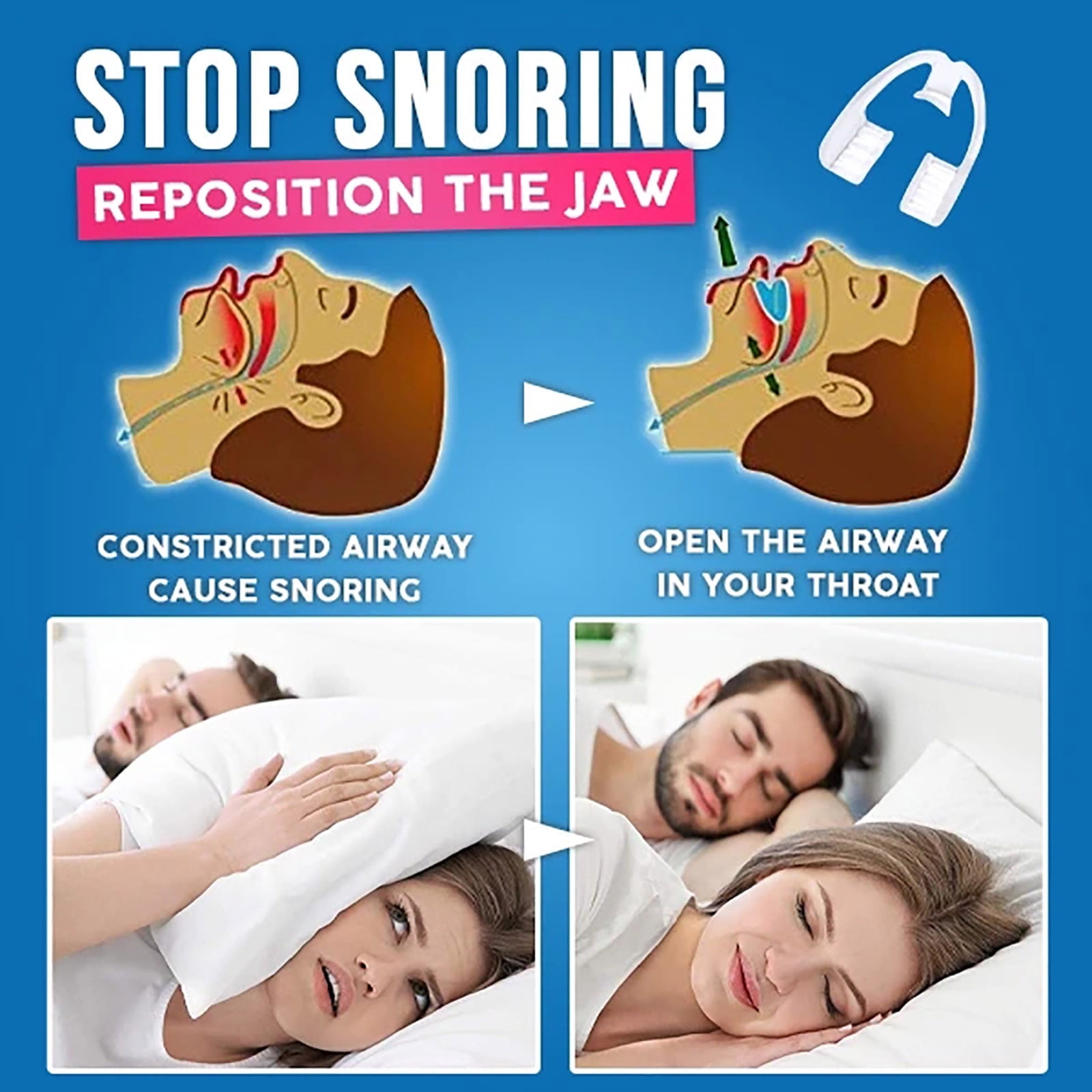 SBYZK Teeth Grinding Protector - Say goodbye to snoring - Promote ...