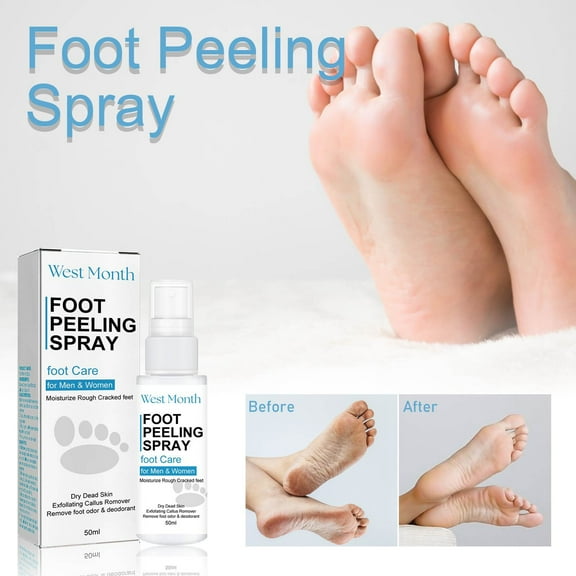 SDJMa Foot Peeling Spray - Effectively Removes Rough Dead And Calloused Skin - Moisturize And Nourish Your Feet In The Dry Season - 50ml
