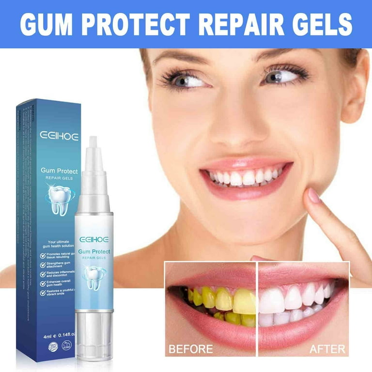 SDJMa Gum Gel - Gum Shield Gel - Teeth Whitening Essence Pen