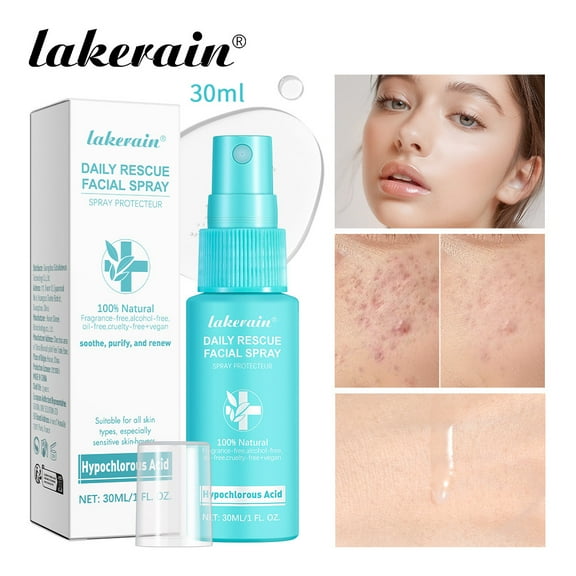 SDJMa Hypochlorous Acid Spray,Daily Facial Spray for Sensitive Skin, Hypochlorous Acid Spray Helps Calm Redness, Acne and Breakouts. Supports Eczema-Prone and Acne-Prone Skin 30ml