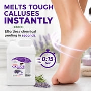 SPA REDI Callus Remover - Removes Toughest Calluses in Seconds and Smooths Dry Cracked Heels, Softens and Smooths Feet, Lavender & Rosemary - 128 Oz