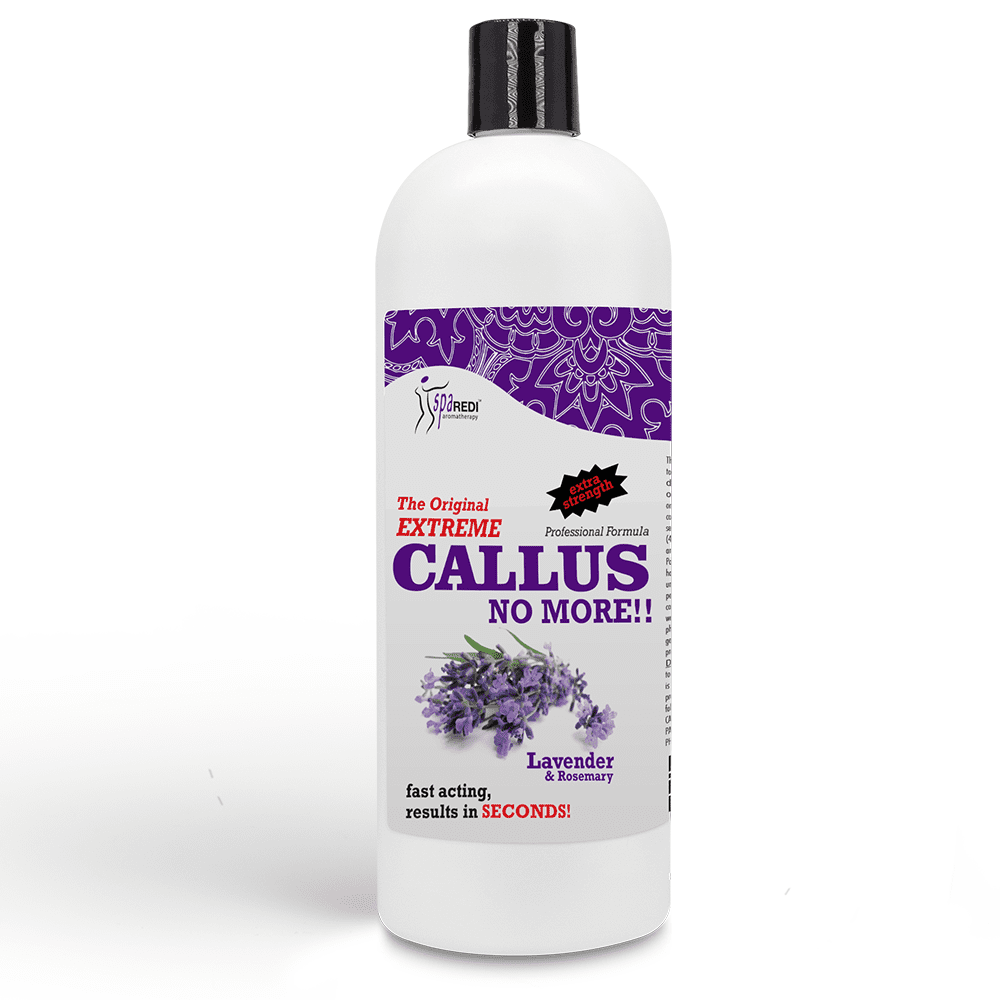 SPA REDI Callus Remover - Removes Toughest Calluses in Seconds and Smooths Dry Cracked Heels, Softens and Smooths Feet, Lavender & Rosemary - 32 Oz