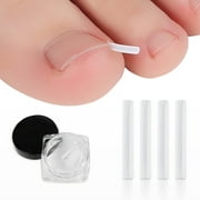 SPRING PARK 10Pcs Nail Patch Sticker Toenail Ingrown Toe Correction Foot Repair Treatment