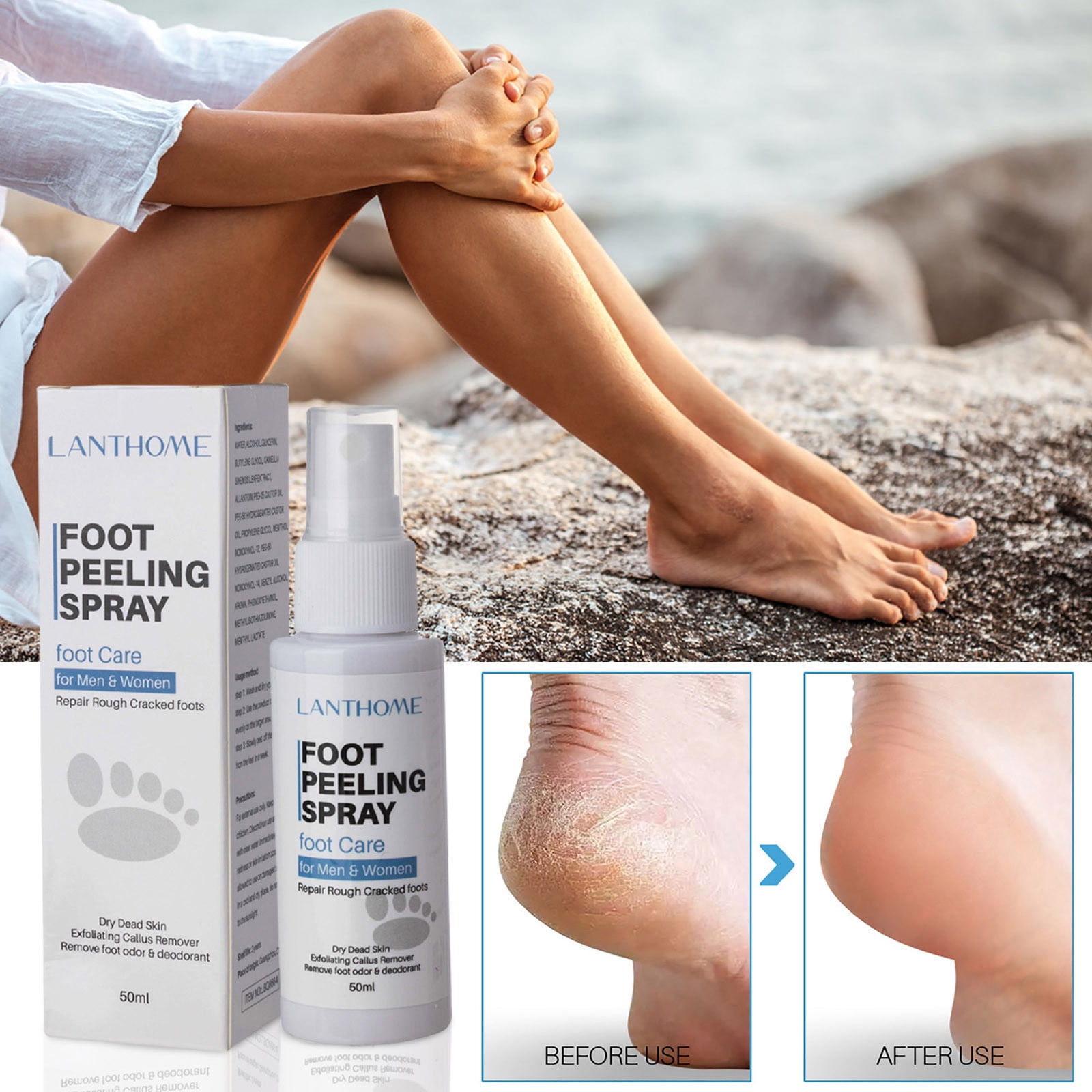 Urea Cream 40% plus Salicylic Acid 2%, Intensive Foot Cream for