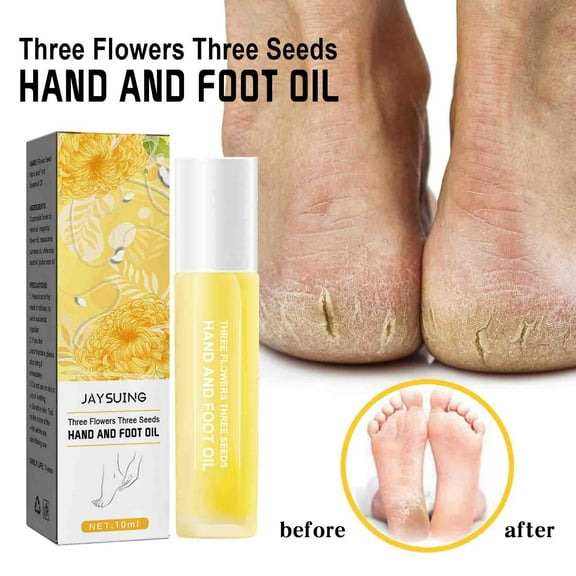 SUMDUINO Three Flowers Hand And Foot Essential Oil Repairs Chapped, Dry, Itchy, Moisturizing Skin On Hands And Feet,10ml - Foot Cream for Dry Feet