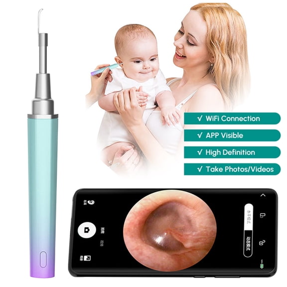 SZROBOY Modern Ear Wax Removal Tool, Ear Wax Removal with Camera, Ear Wax Removal Kit,1920P HD Ear Cleaner, Ear Cleaning Kit Compatible for iPhone, iPad, AndroidBlue