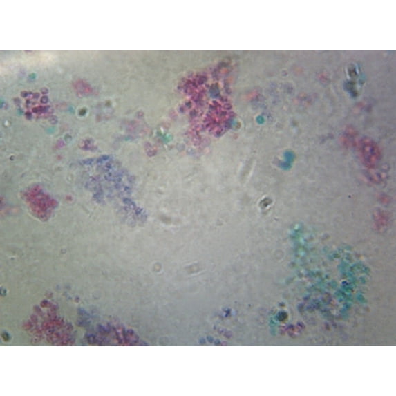 Saccharomyces Cerevisiae, Living Yeast; Whole-mount by Go Science Crazy