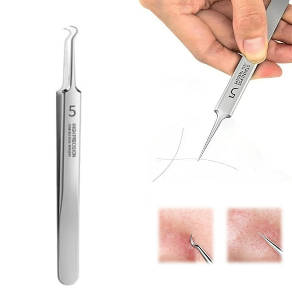 Safeglitz Usiveinborn Stainless Steel Blackhead Remover Tweezers - Facial Tweezers for Precise Extraction