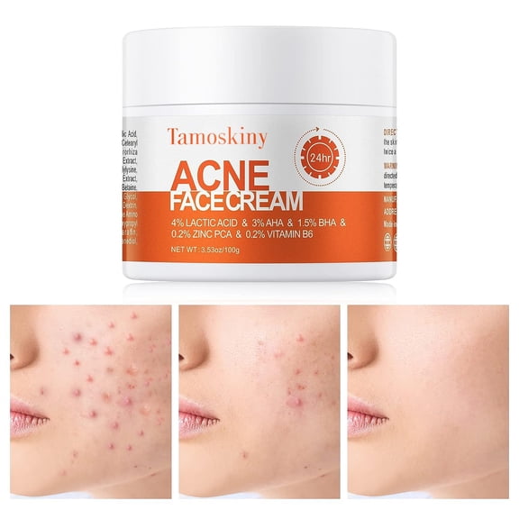 Salicylic Acid Cystic Acne Treatment - Face & Body Spot Treatment Cream, Clearing Moisturizer for Teens & Adults, 3.53 OZ