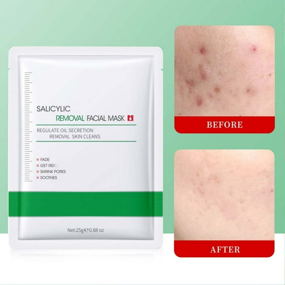 Salicylic Acid Hydrating Face Mask - Exfoliate & Clear Pores, Moisturize Dry Skin, Prevent Acne Breakouts, Oil Balance, Soothe & Refresh Dull Complexion