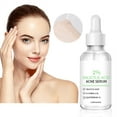 Salicylic Acid Serum, Exfoliation 2 Salicylic Acid Facial Serum for Blemish Skin and