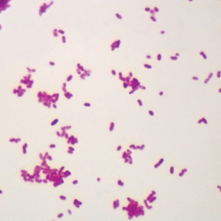 Salmonella Typhimurium, W.M. Microscope Slide