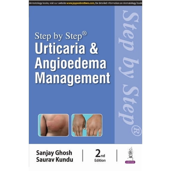 Sanjay Ghosh,Saurav Kundu Step by Step: Urticaria & Angioedema Management (Paperback)