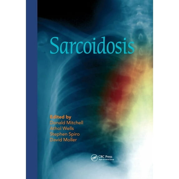Sarcoidosis, (Paperback)