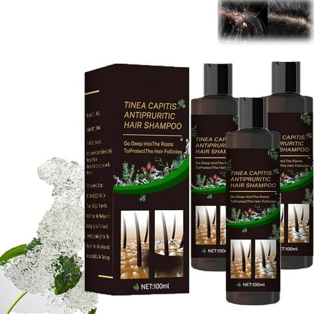 Scalp Repair Biological Shampoo,Anti Itch Dandruff Shampoo,Tinea Capitis Antipruritic Hair Shampoo,Dandruff Treatment Shampoo,Deep into the Roots,Protect the Hair Follicles (3pcs)