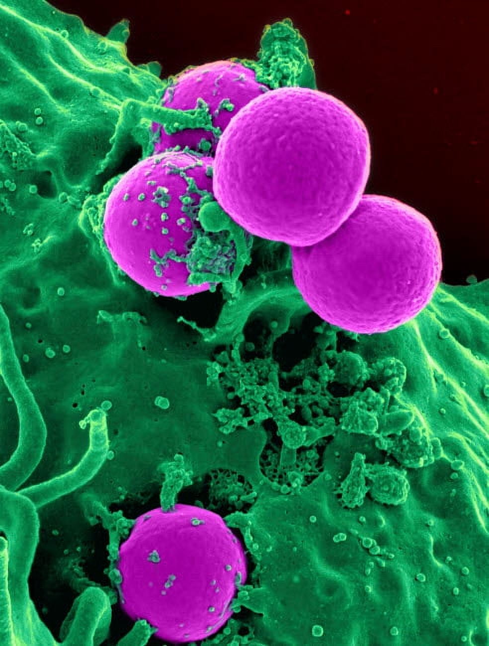 Scanning electron micrograph of a human neutrophil ingesting MRSA ...