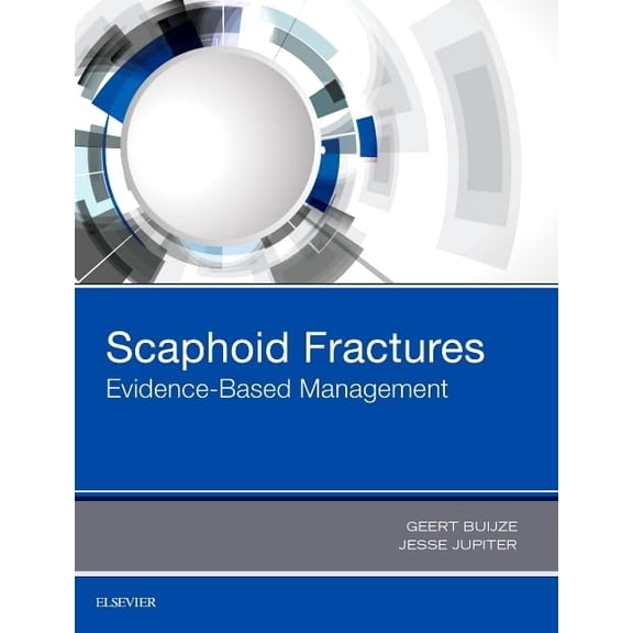 Pre-Owned Scaphoid Fractures: Evidence-Based Management