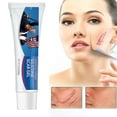 Scar,Acne Scar Treatment,Scar Gel,Advanced Scar Old and New Scars Reduces the Appearance of